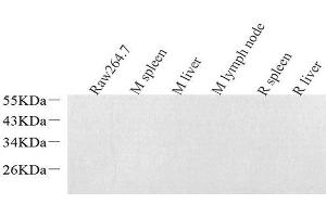 Western Blot analysis of various samples using Lysozyme Polyclonal Antibodyat dilution of 1:1000. (LYZ 抗体)