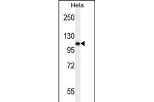 ANDR Antibody (Sumo-site) (ABIN389077 and ABIN2850530) western blot analysis in Hela cell line lysates (35 μg/lane). (Androgen Receptor 抗体  (AA 365-392))