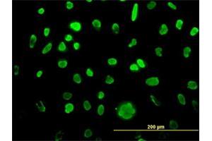 Immunofluorescence (IF) image for anti-Minichromosome Maintenance Complex Component 3 (MCM3) (AA 699-808) antibody (ABIN561761)