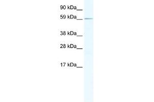 WB Suggested Anti-RBM14 Antibody Titration:  1. (RBM14 抗体  (N-Term))