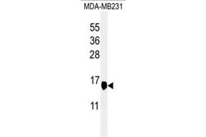 Western blot analysis of hSUMO4-M55 WT specific (R) in MDA-M cell line lysates (35 μg/lane). (SUMO4 抗体  (Mutant, Val55))