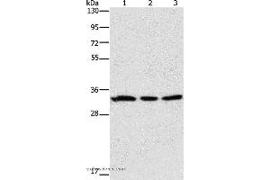 Western blot analysis of 293T and human colon cancer tissue, 231 cell, using GPA33 Polyclonal Antibody at dilution of 1:600 (GPA33 抗体)