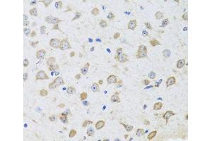 Immunohistochemistry of paraffin-embedded Mouse brain using ARL6 Polyclonal Antibody at dilution of 1:100 (40x lens). (ARL6 抗体)