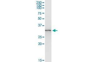 ANXA3 (Human) IP-WB Antibody Pair