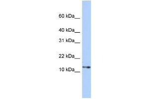 WB Suggested Anti-GNGT2 Antibody Titration: 0. (GNGT2 抗体  (Middle Region))