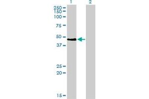 Western Blot analysis of PAX2 expression in transfected 293T cell line by PAX2 monoclonal antibody (M01), clone 3C7. (PAX2A 抗体  (AA 194-303))
