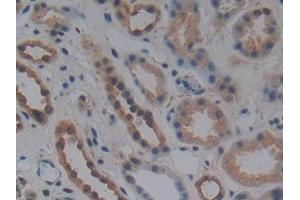 DAB staining on IHC-P; Samples: Human Kidney Tissue (WNT10B 抗体  (AA 30-322))