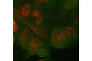 IF analysis of ST7 using anti-ST7 antibody (ABIN4886732) and anti-Beta Tubulin antibody (ABIN7602743). (ST7 抗体  (Middle Region))