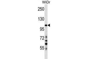 SUSD2 Antibody (C-term) western blot analysis in WiDr cell line lysates (35 µg/lane). (SUSD2 抗体  (C-Term))