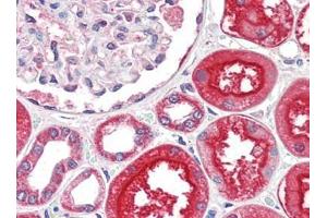 Human Kidney (formalin-fixed, paraffin-embedded) stained with ACE2at 2. (ACE2 抗体  (N-Term))