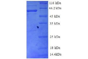 GNB2 Protein (AA 21-327, partial) (GST tag)