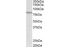 Western Blotting (WB) image for anti-ATP-Binding Cassette, Sub-Family B (MDR/TAP), Member 5 (ABCB5) (Internal Region) antibody (ABIN238622)