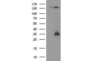 Western Blotting (WB) image for anti-NQO2 (NQO2) antibody (ABIN1499816) (NQO2 抗体)