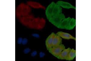 ABIN6265122 and ABIN6279093 staining Hela cells(30 min of UV treatment) by IF/ICC.