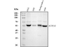 Western blot analysis of ALDH1A2 using anti-ALDH1A2 antibody (ABIN4886449). (ALDH1A2 抗体  (AA 1-110))