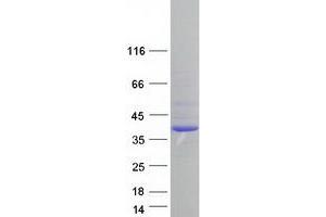 Western Blotting (WB) image for SUMO1 Activating Enzyme Subunit 1 (SAE1) (Transcript Variant 2) protein (Myc-DYKDDDDK Tag) (ABIN2731358)