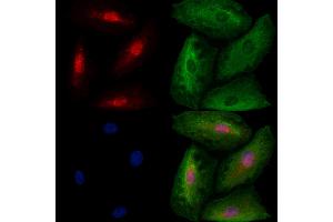 ABIN6259602 and ABIN6273527 staining  cells by IF/ICC. (TBR1 抗体  (N-Term))