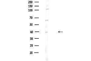 anti-SET Nuclear Oncogene (SET) (N-Term) antibody