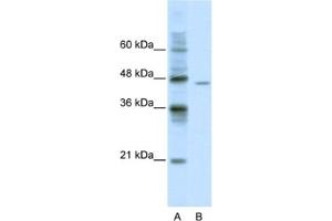 Western Blotting (WB) image for anti-DEAD (Asp-Glu-Ala-Asp) Box Polypeptide 25 (DDX25) antibody (ABIN2461348) (DDX25 抗体)