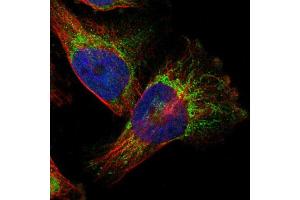 Immunofluorescent staining of U251 cells using TAOK3 polyclonal antibody  shows positivity in mitochondria (green). (TAO Kinase 3 抗体  (AA 323-432))