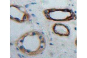 Immunohistochemistry (IHC) image for anti-Inhibitor of KB Kinase beta Interacting Protein (IKbIP) (AA 78-301) antibody (ABIN1859322)