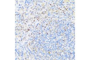 Immunohistochemistry of paraffin-embedded rat spleen using UQCC2 antibody  at dilution of 1:100 (40x lens).