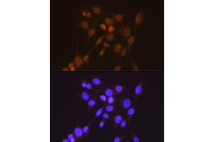 Immunofluorescence analysis of NIH-3T3 cells using [KO Validated] Smad2 Rabbit mAb (ABIN7270344) at dilution of 1:100 (40x lens). (SMAD2 抗体)