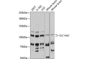 Western Blotting (WB) image for anti-Solute Carrier Family 14 (Urea Transporter, Kidney) Member 2 (SLC14A2) (AA 420-580) antibody (ABIN6147851)