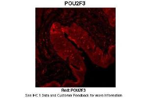 Sample Type :  Mouse tongue tissue  Primary Antibody Dilution :  1:100  Secondary Antibody :  Anti-rabbit-Cy3  Secondary Antibody Dilution :  1:500  Color/Signal Descriptions :  Red: POU2F3  Gene Name :  POU2F3  Submitted by :  Dr. (POU2F3 抗体  (N-Term))
