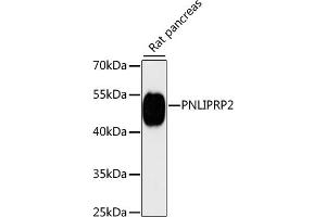 Western blot analysis of extracts of rat pancreas, using PNLIPRP2 antibody (ABIN6130643, ABIN6145842, ABIN6145843 and ABIN6216695) at 1:3000 dilution. (PNLIPRP2 抗体  (AA 301-470))