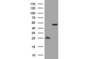 Image no. 4 for anti-3-Oxoacyl-ACP Synthase, Mitochondrial (OXSM) (AA 78-343) antibody (ABIN1491676) (OXSM 抗体  (AA 78-343))