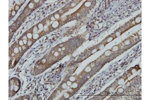 Immunoperoxidase of monoclonal antibody to MRRF on formalin-fixed paraffin-embedded human small Intestine. (MRRF 抗体  (AA 163-262))