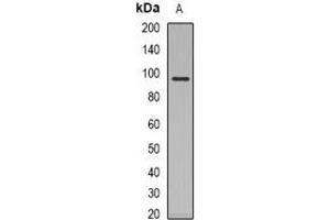 Western Blotting (WB) image for anti-Nuclear Receptor Subfamily 3, Group C, Member 1 (Glucocorticoid Receptor) (NR3C1) antibody (ABIN7303800)