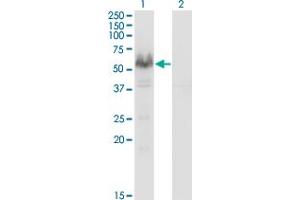 Western Blot analysis of PPP3CA expression in transfected 293T cell line by PPP3CA monoclonal antibody (M03), clone 2G8. (PPP3CA 抗体  (AA 1-84))