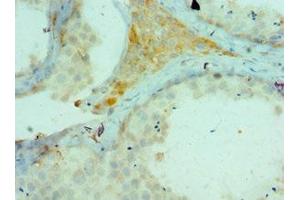 Immunohistochemistry of paraffin-embedded human testis tissue using ABIN7172781 at dilution of 1:100 (CTCFL 抗体  (AA 1-270))