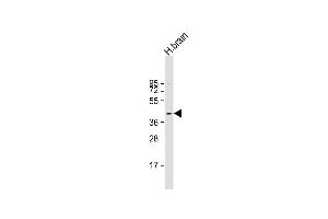 Anti-PRKACB Antibody (K29) at 1:1000 dilution + human brain lysate Lysates/proteins at 20 μg per lane. (PRKACB 抗体  (N-Term))