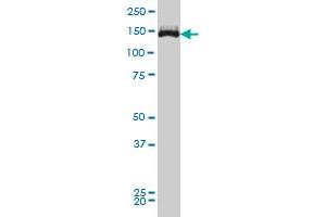 Viral Entry Inhibition (VEI) image for anti-Tripartite Motif Containing 33 (TRIM33) (AA 1006-1106) antibody (ABIN599250) (TRIM33 抗体  (AA 1006-1106))