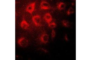 Immunofluorescent analysis of Wilms Tumor 1 staining in MCF7 cells. (WT1 抗体)