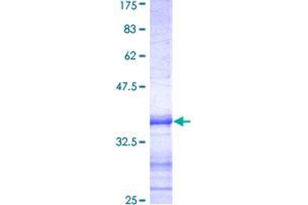 HDAC5 Protein (AA 330-429) (GST tag)