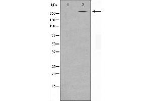 Western blot analysis on MDA-MB-435 cell lysate using NCoR1 Antibody,The lane on the left is treated with the antigen-specific peptide. (NCOR1 抗体  (N-Term))