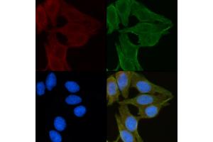 ABIN6260054 and ABIN6272249 staining Hela cells(30 min of UV treatment) by IF/ICC. (ARRDC1 抗体  (C-Term))