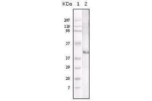 Western blot analysis using LAL mouse mAb against LAL recombinant protein. (Lipase A 抗体)