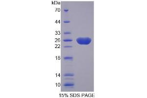 SDS-PAGE analysis of Human Fibulin 3 Protein.