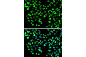 Immunofluorescence analysis of MCF-7 cells using GRM4 antibody (ABIN5974386). (Metabotropic Glutamate Receptor 4 抗体)