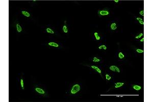 Immunofluorescence of monoclonal antibody to PKN1 on HeLa cell. (PKN1 抗体  (AA 462-615))