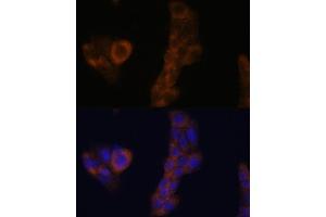Immunofluorescence (IF) image for anti-Ribosomal Protein L23A (RPL23A) (AA 1-156) antibody (ABIN1682576)