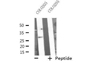 Western blot analysis of extracts from COLO205 cells, using MSX2 antibody. (Msx2/Hox8 抗体  (Internal Region))