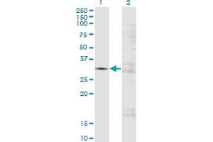 Western Blot analysis of FCN3 expression in transfected 293T cell line by FCN3 monoclonal antibody (M01A), clone 4B4. (FCN3 抗体  (AA 1-288))