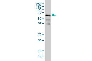 Western Blotting (WB) image for anti-Insulin-Like Growth Factor 2 mRNA Binding Protein 3 (IGF2BP3) (AA 1-579) antibody (ABIN524077)