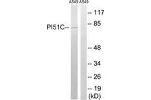 Western blot analysis of extracts from A549 cells, using PIP5K1C Antibody. (PIP5K1C 抗体  (AA 305-354))